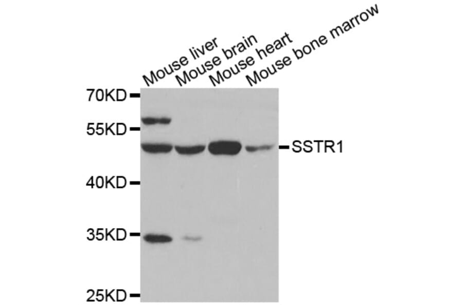 Western blot - SSTR1 antibody from Signalway Antibody (38599) - Antibodies.com