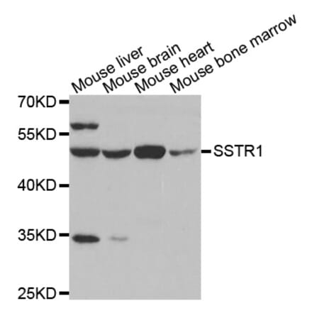 Western blot - SSTR1 antibody from Signalway Antibody (38599) - Antibodies.com
