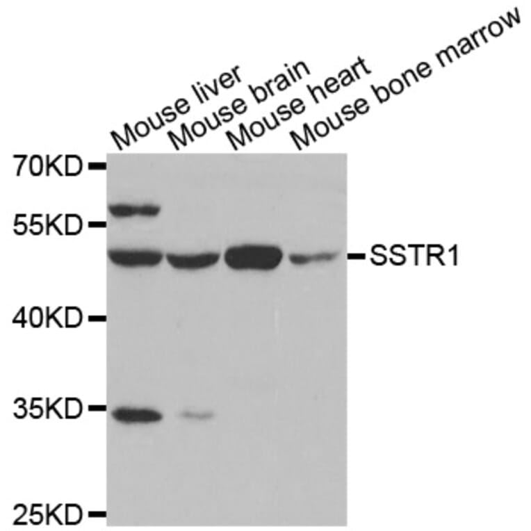Western blot - SSTR1 antibody from Signalway Antibody (38599) - Antibodies.com