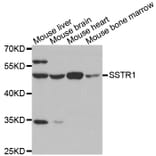 Western blot - SSTR1 antibody from Signalway Antibody (38599) - Antibodies.com