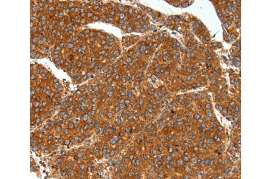 Immunohistochemistry - SSTR1 antibody from Signalway Antibody (38599) - Antibodies.com