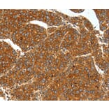 Immunohistochemistry - SSTR1 antibody from Signalway Antibody (38599) - Antibodies.com
