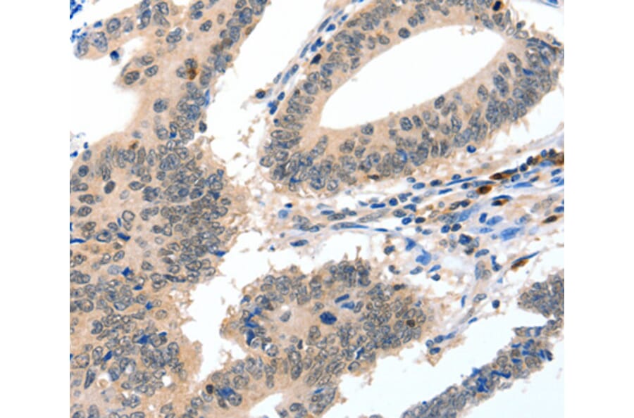 Immunohistochemistry - CASP3 antibody from Signalway Antibody (38606) - Antibodies.com