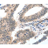 Immunohistochemistry - CASP3 antibody from Signalway Antibody (38606) - Antibodies.com
