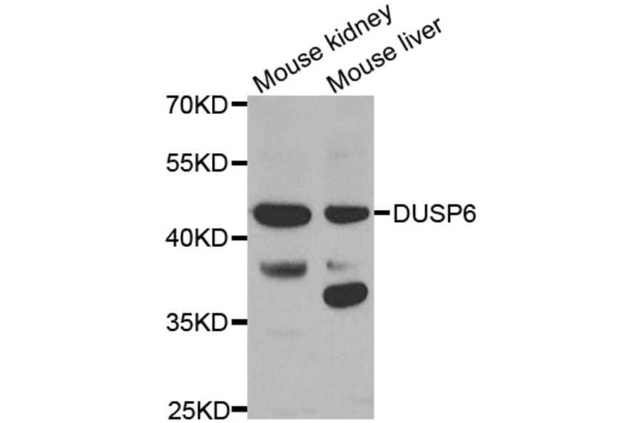 Western blot - DUSP6 antibody from Signalway Antibody (38613) - Antibodies.com