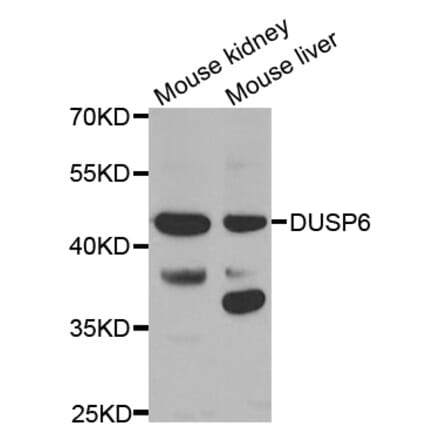 Western blot - DUSP6 antibody from Signalway Antibody (38613) - Antibodies.com