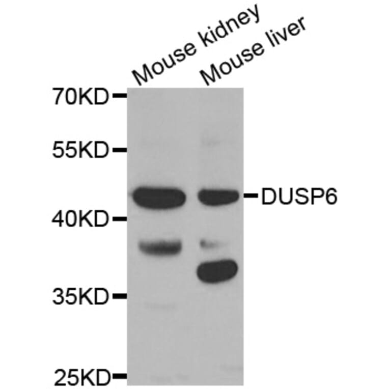 Western blot - DUSP6 antibody from Signalway Antibody (38613) - Antibodies.com