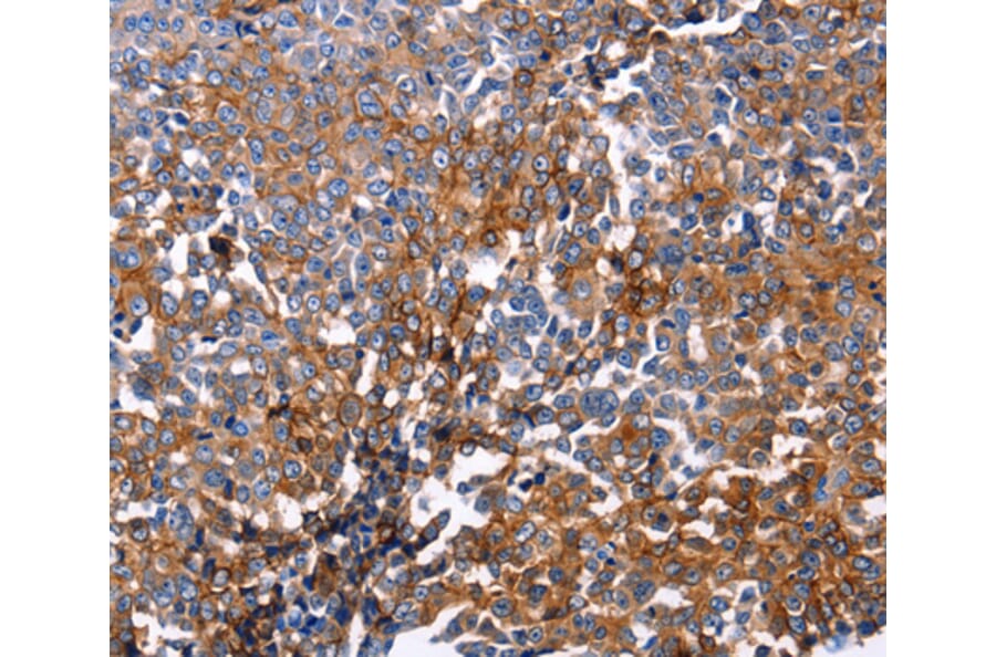 Immunohistochemistry - DUSP6 antibody from Signalway Antibody (38613) - Antibodies.com