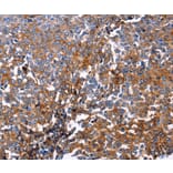 Immunohistochemistry - DUSP6 antibody from Signalway Antibody (38613) - Antibodies.com