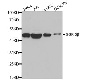 Western blot - GSK3B antibody from Signalway Antibody (38616) - Antibodies.com