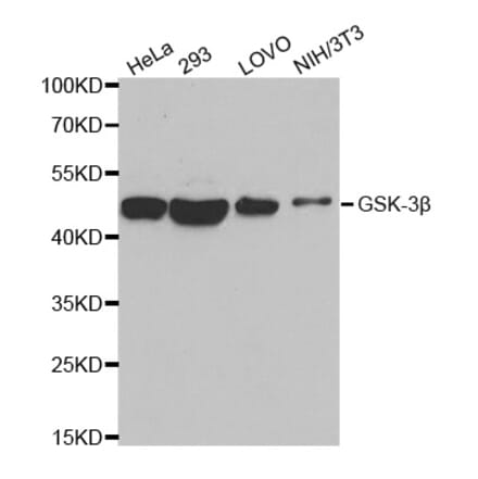 Western blot - GSK3B antibody from Signalway Antibody (38616) - Antibodies.com