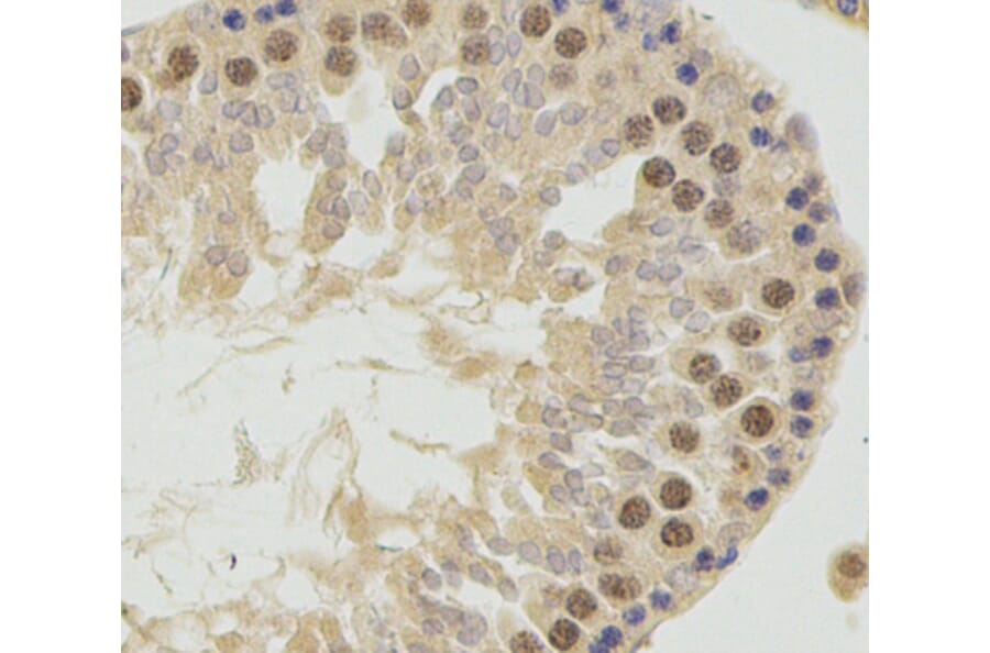 Immunohistochemistry - GSK3B antibody from Signalway Antibody (38616) - Antibodies.com