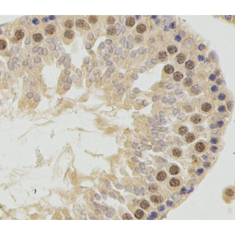 Immunohistochemistry - GSK3B antibody from Signalway Antibody (38616) - Antibodies.com