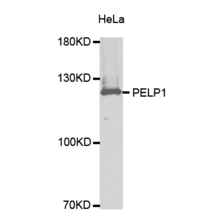 Western blot - PELP1 antibody from Signalway Antibody (38628) - Antibodies.com