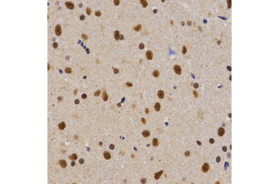 Immunohistochemistry - PELP1 antibody from Signalway Antibody (38628) - Antibodies.com