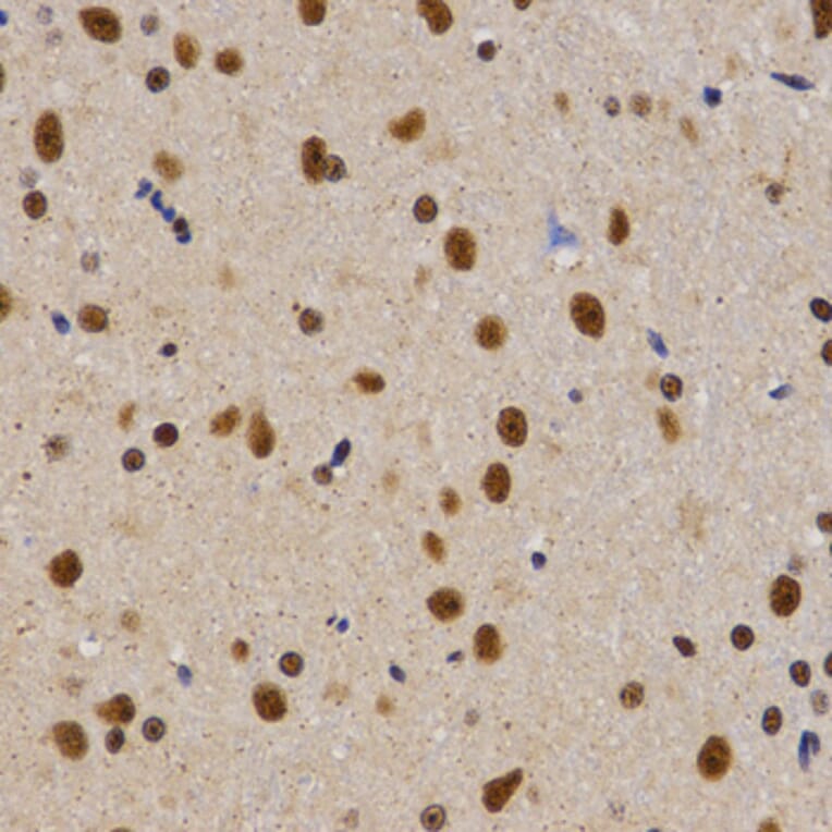 Immunohistochemistry - PELP1 antibody from Signalway Antibody (38628) - Antibodies.com