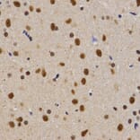 Immunohistochemistry - PELP1 antibody from Signalway Antibody (38628) - Antibodies.com