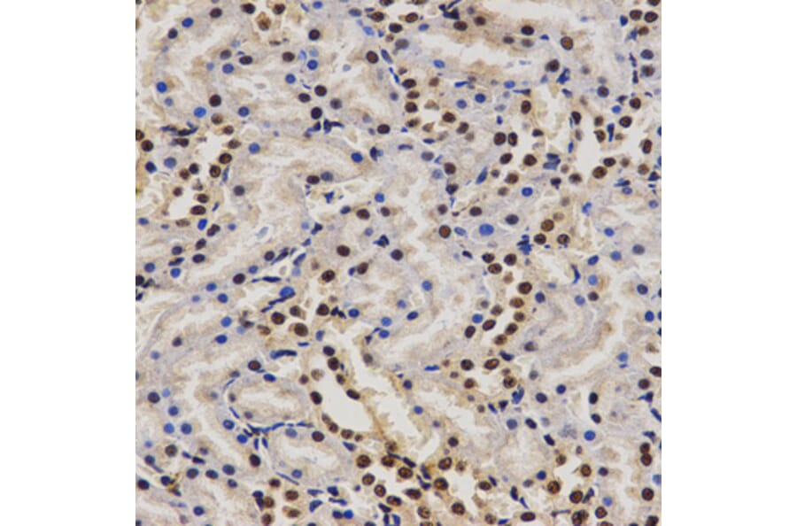 Immunohistochemistry - PELP1 antibody from Signalway Antibody (38628) - Antibodies.com