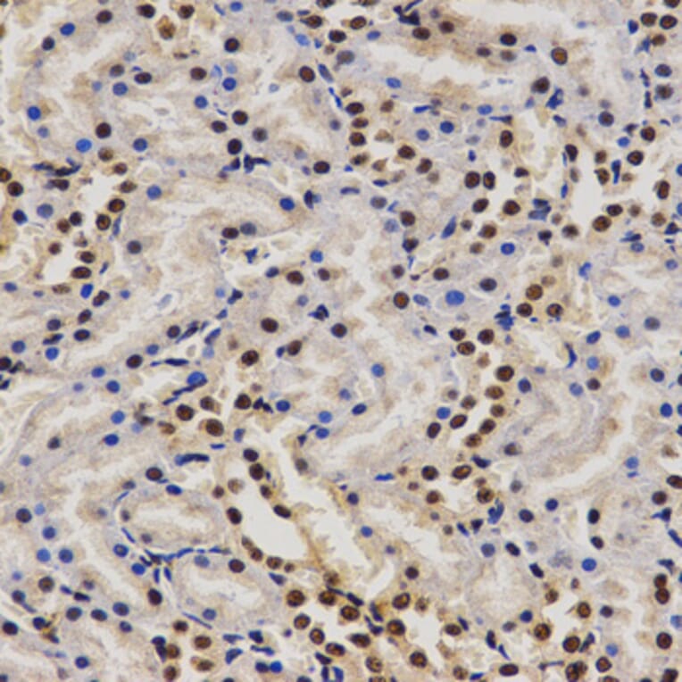 Immunohistochemistry - PELP1 antibody from Signalway Antibody (38628) - Antibodies.com