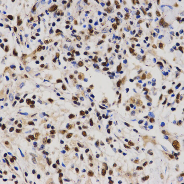 Immunohistochemistry - PELP1 antibody from Signalway Antibody (38628) - Antibodies.com