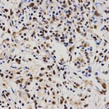 Immunohistochemistry - PELP1 antibody from Signalway Antibody (38628) - Antibodies.com