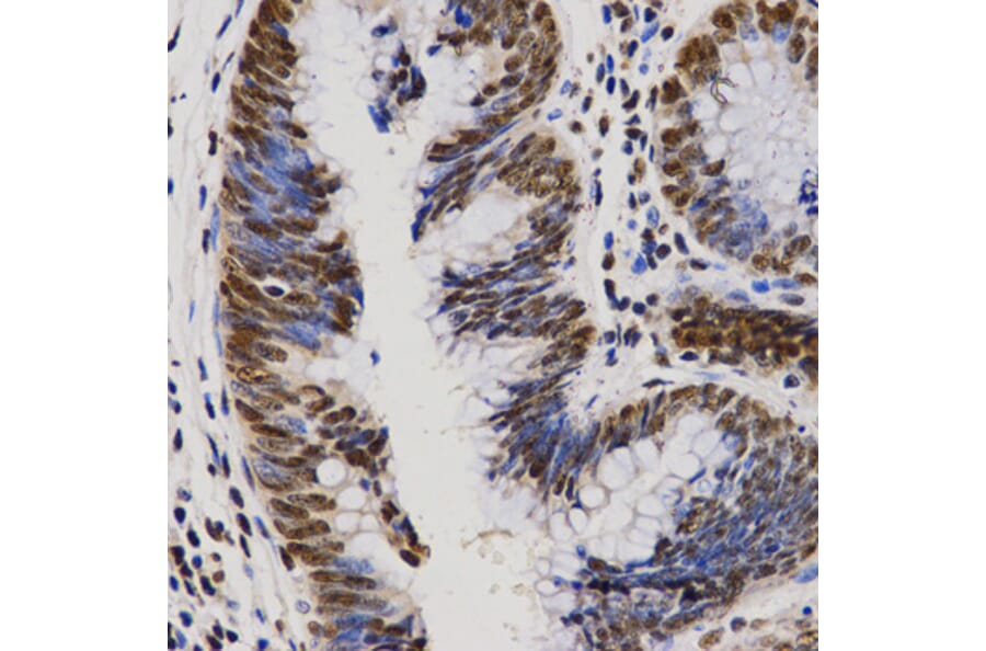 Immunohistochemistry - PELP1 antibody from Signalway Antibody (38628) - Antibodies.com