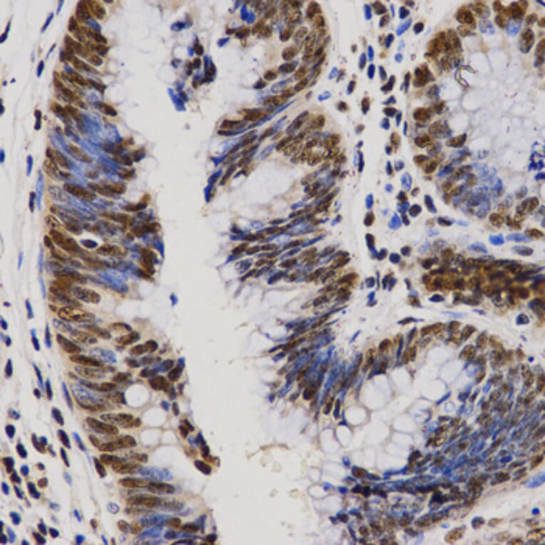 Immunohistochemistry - PELP1 antibody from Signalway Antibody (38628) - Antibodies.com