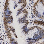 Immunohistochemistry - PELP1 antibody from Signalway Antibody (38628) - Antibodies.com