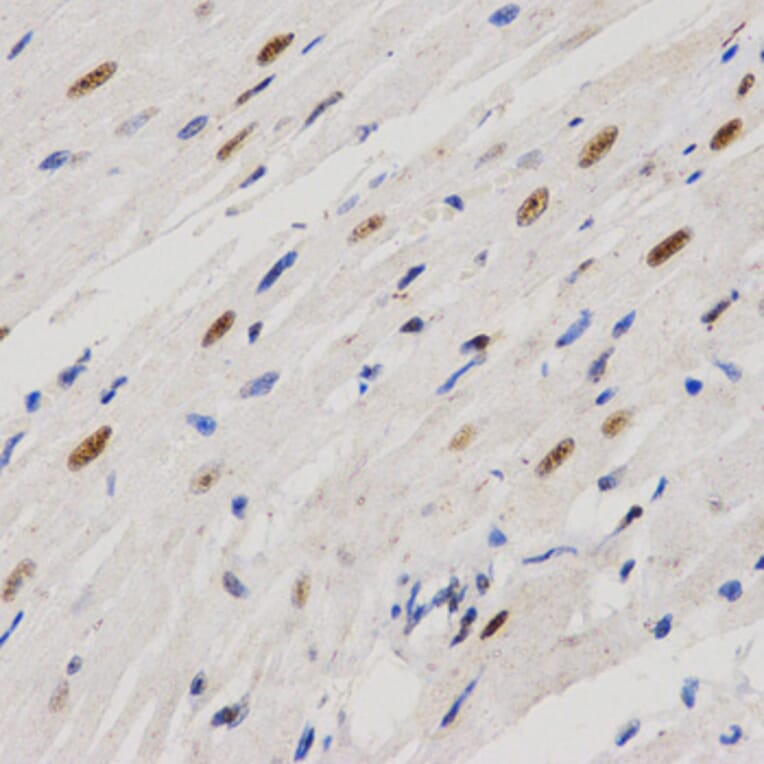 Immunohistochemistry - PELP1 antibody from Signalway Antibody (38628) - Antibodies.com