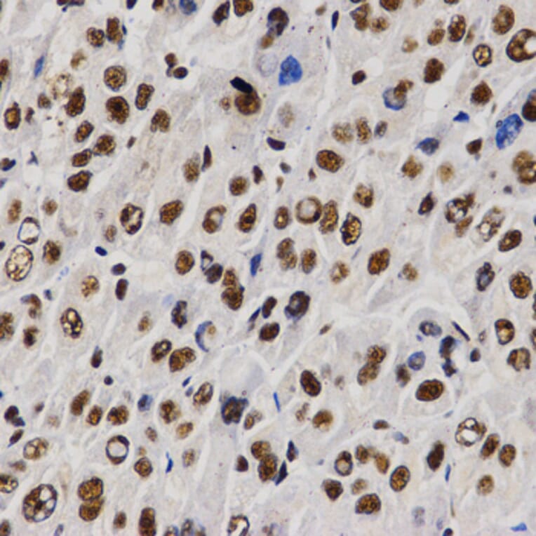 Immunohistochemistry - PELP1 antibody from Signalway Antibody (38628) - Antibodies.com