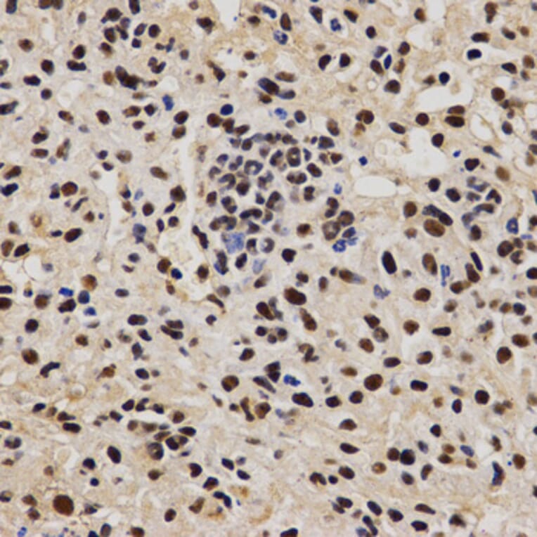 Immunohistochemistry - PELP1 antibody from Signalway Antibody (38628) - Antibodies.com