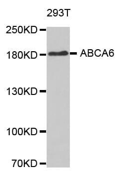Western blot analysis of extracts of 293T cell line, using ABCA6 antibody.