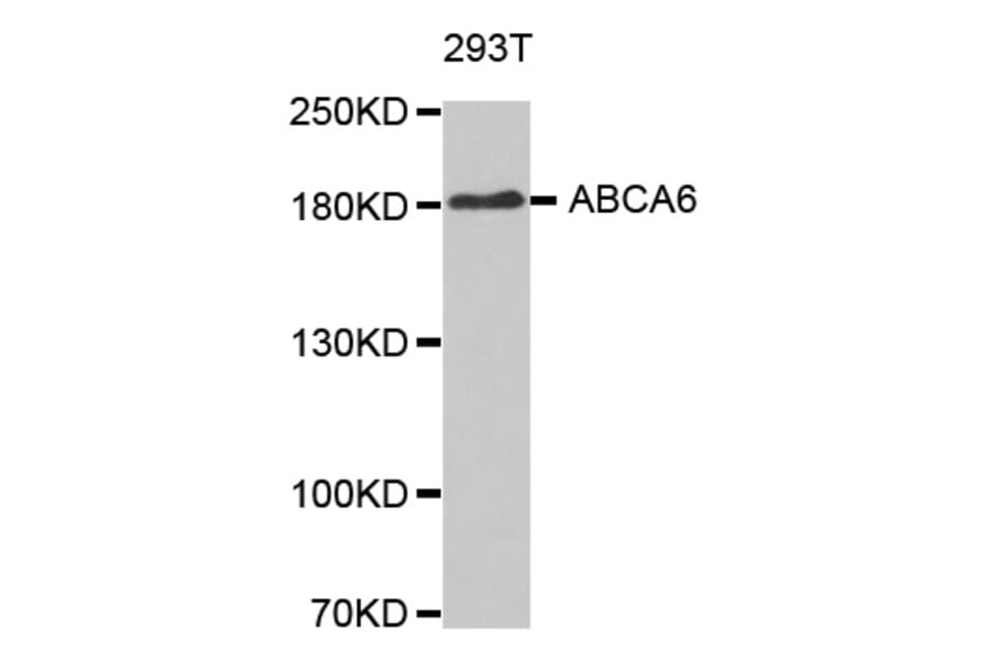 Western blot - ABCA6 antibody from Signalway Antibody (38630) - Antibodies.com
