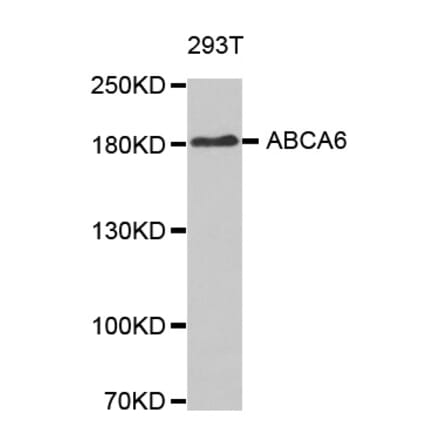 Western blot - ABCA6 antibody from Signalway Antibody (38630) - Antibodies.com