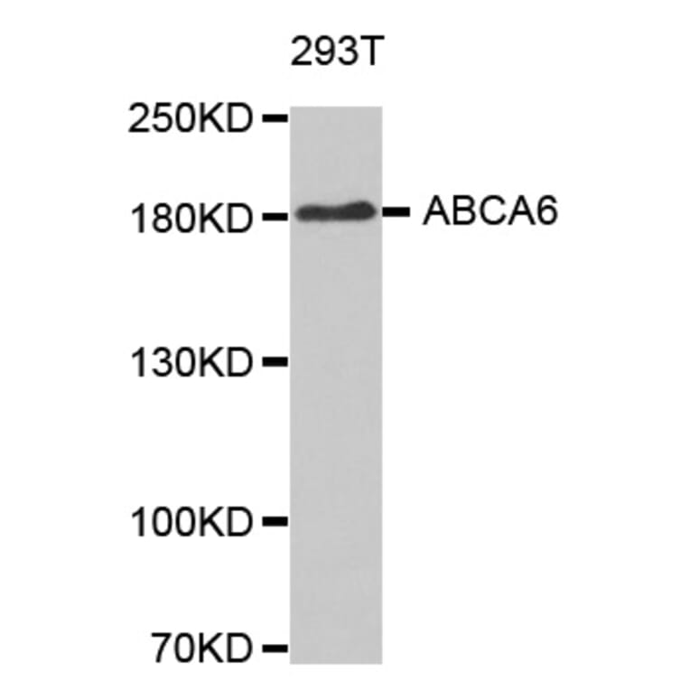 Western blot - ABCA6 antibody from Signalway Antibody (38630) - Antibodies.com