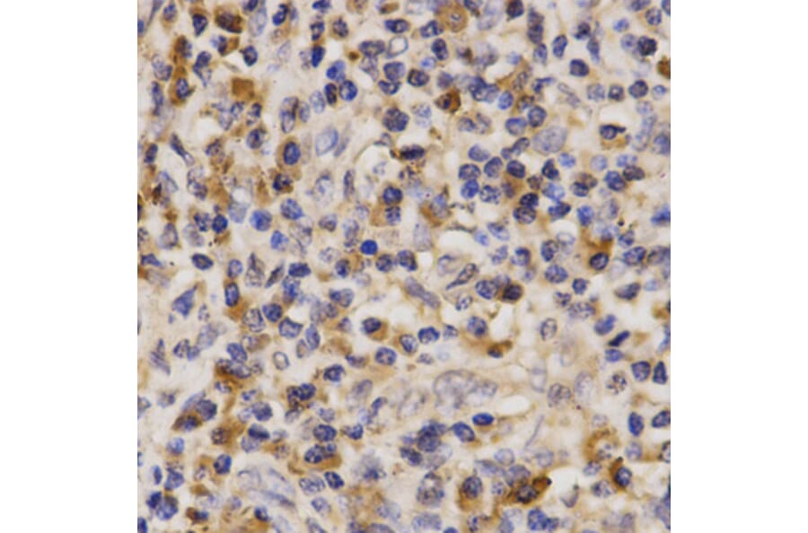 Immunohistochemistry - ABCA6 antibody from Signalway Antibody (38630) - Antibodies.com