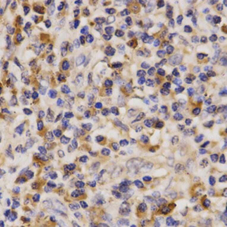 Immunohistochemistry - ABCA6 antibody from Signalway Antibody (38630) - Antibodies.com