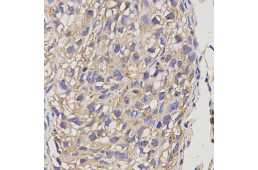 Immunohistochemistry - ABCA6 antibody from Signalway Antibody (38630) - Antibodies.com