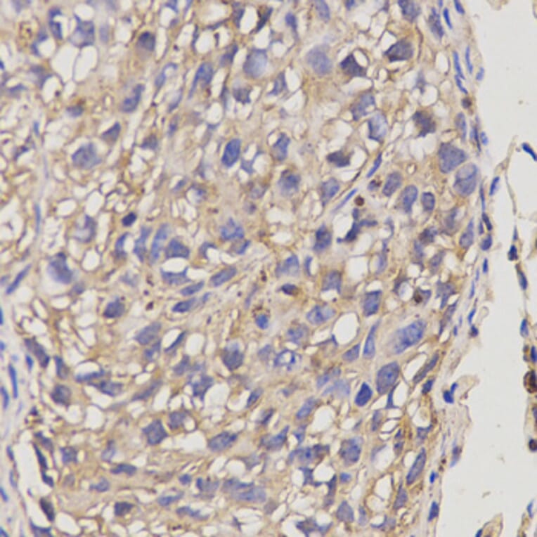 Immunohistochemistry - ABCA6 antibody from Signalway Antibody (38630) - Antibodies.com