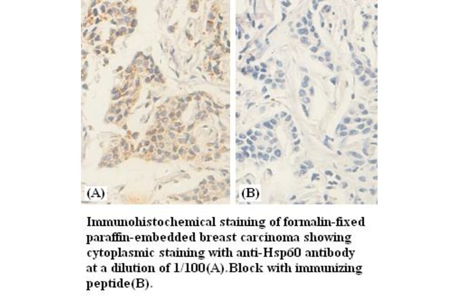 hsp60 Antibody from Signalway Antibody (39380) - Antibodies.com
