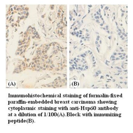 hsp60 Antibody from Signalway Antibody (39380) - Antibodies.com