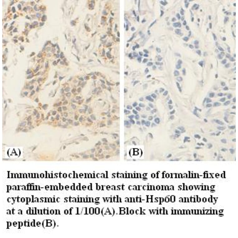 hsp60 Antibody from Signalway Antibody (39380) - Antibodies.com