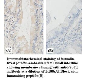 PepT1 Antibody from Signalway Antibody (39383) - Antibodies.com