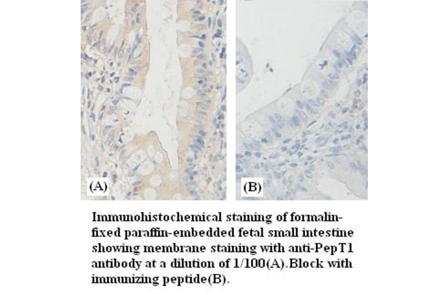 PepT1 Antibody from Signalway Antibody (39383) - Antibodies.com