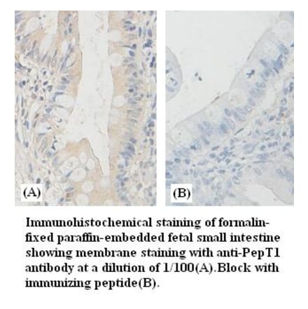 PepT1 Antibody from Signalway Antibody (39383) - Antibodies.com