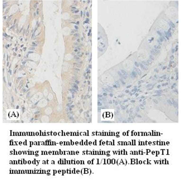 PepT1 Antibody from Signalway Antibody (39383) - Antibodies.com