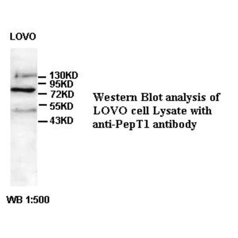 PepT1 Antibody from Signalway Antibody (39383) - Antibodies.com