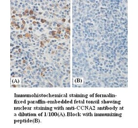 CCNA2 Antibody from Signalway Antibody (39386) - Antibodies.com