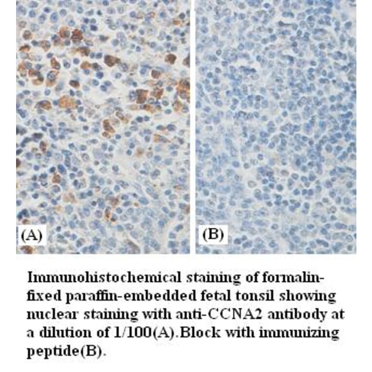 CCNA2 Antibody from Signalway Antibody (39386) - Antibodies.com