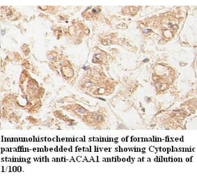 ACAA1 Antibody from Signalway Antibody (39398) - Antibodies.com